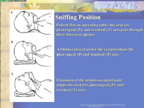 18 Basics Of Pediatric Airway Anatomy Physiology And Management