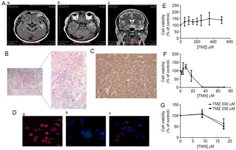 Glioblastoma Entities Express Subtle Differences In Molecular