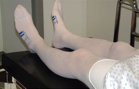 Surgical Patients Adherence To The Use Of Compression Stockings