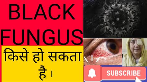 Black Fungus Mucormycosis Youtube