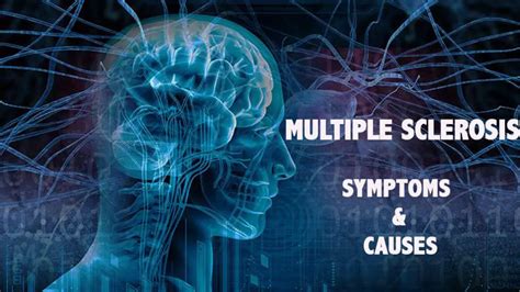 multiple sclerosis symptoms and causes psyspeaks