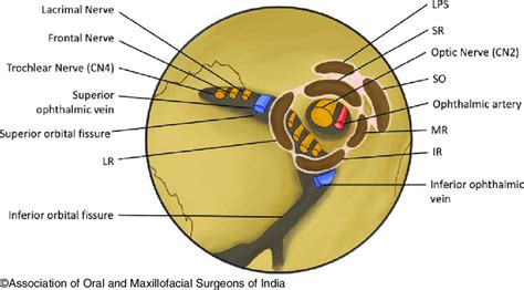 2 Structures Passing Through The Superior And Inferior Orbital Fissures Download Scientific