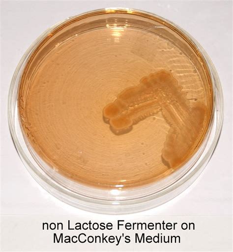 Non Lactose Fermenter On Macconkes Meduim A Photo On Flickriver