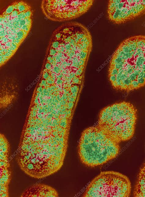 Gardnerella Vaginalis Bacteria Stock Image B Science Photo Library