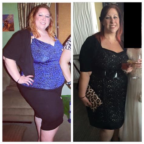 Gastric Sleeve Weight Loss By Week Weightlosslook