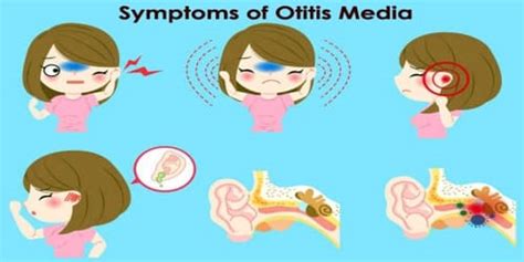 Otitis Media Causes Symptoms And Risk Factors Assignment Point