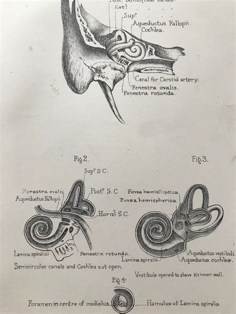 1882 Apex Of Cochlea Original Antique Print Medical Decor Anatomy