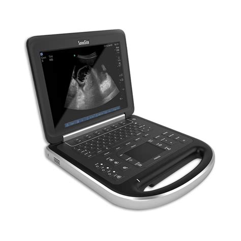 Sonosite Edge Ultrasound System Planmedical