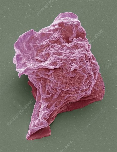 Lymphoma Cancer Cell Sem Stock Image C0230859 Science Photo Library