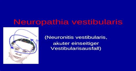 Neuropathia Vestibularis Neuronitis Vestibularis Akuter Einseitiger