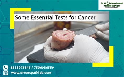 Essential Tests For Cancer M N Chatterjee Memorial Pathlology Lab