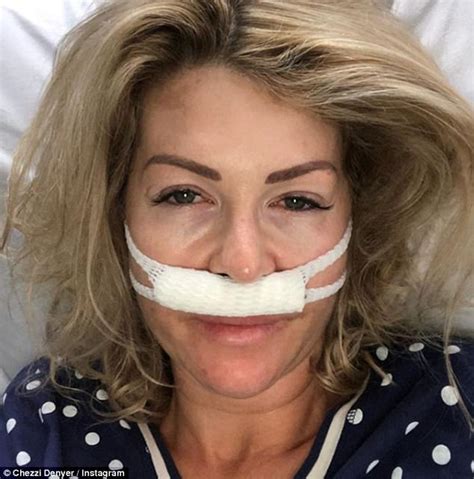 Chezzi Denyer Has Undergone Surgery To Heal Migraines Daily Mail Online