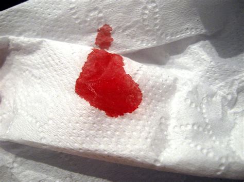 Blood After Stool Wiping Stools Item