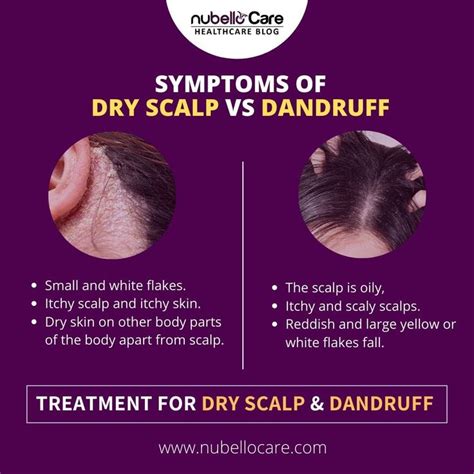 It's true that a dry scalp can cause dandruff in some situations, but an extremely oily scalp can also. Itchy scalp and white flakes can be dandruff or a dry ...