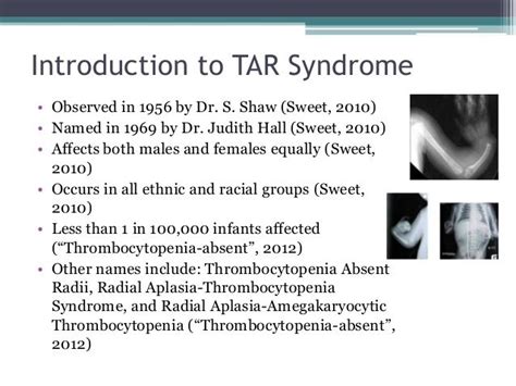 Pin By Nonas Arc On Tar Syndrome Racial Groups Normal Life Syndrome