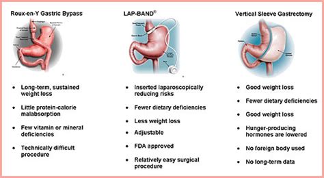 Weight loss is achieved by reducing the size of the stomach with a gastric band or. Obesity Related Diseases and Conditions | Obesity Treatment in India