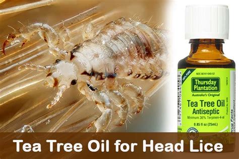 Do Tea Tree Oil Kill Lice Eggs Celsa Mangum