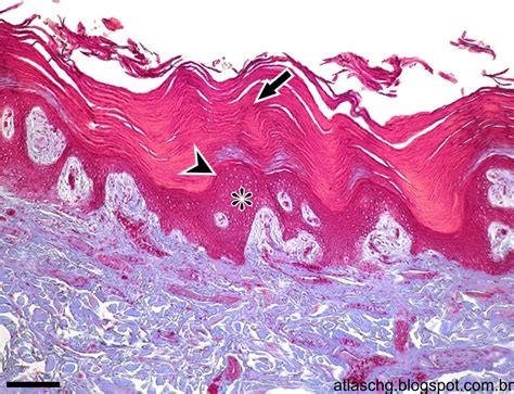 Atlas De Citologia E Histologia Tecido Epitelial De Revestimento Porn Sex Picture