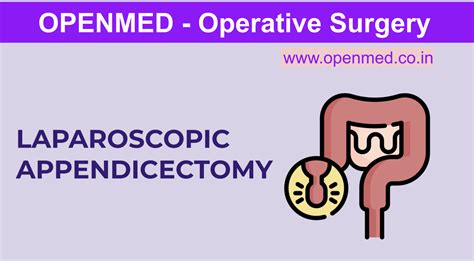 Laparoscopic Appendicectomy Operative Surgery Steps