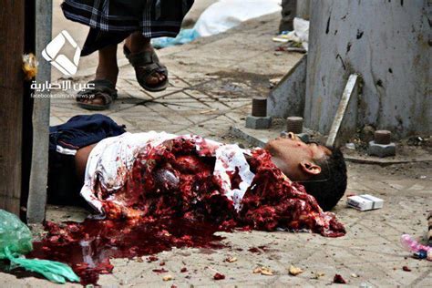 Yemen Rights Monitor Sept 18 19th Massacres Caution