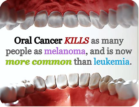 Some common signs of metastatic cancer include: Oral Cancer - Sonoma County Family Dental