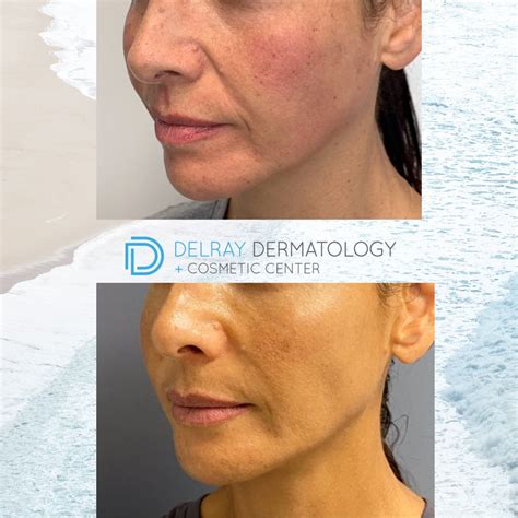 The Magic Of Delray Dermatology Cosmetic Center