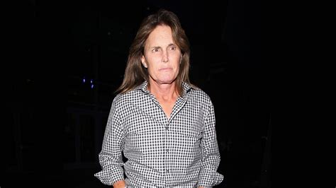 Bruce Jenners New Face A Renowned Plastic Surgeon Explains Facial Feminization