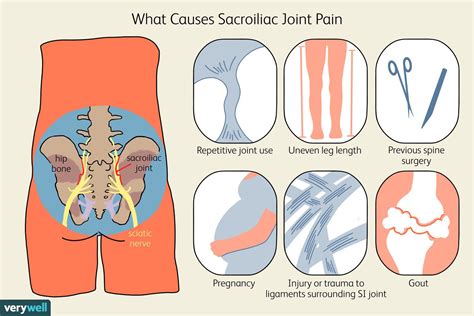 Causes Of Burning Hip Pain And Treatment Options 2022