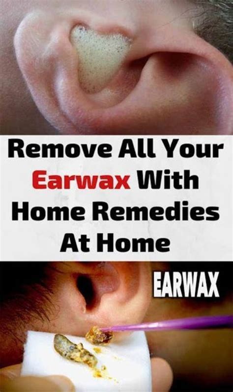 How To Use Hydrogen Peroxide To Remove Ear Wax Ear Wax Clogged Ear