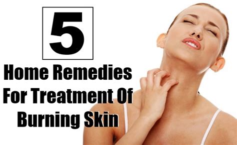 Top 5 Home Remedies For Treatment Of Burning Skin Morpheme Remedies