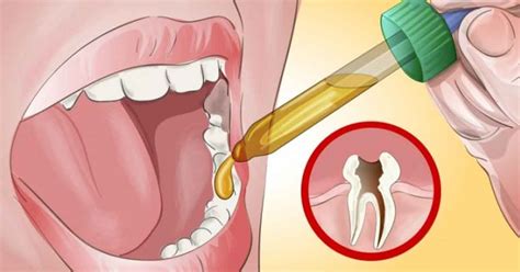 Poznaj Prosty Sposób Na Pozbycie Się Bólu Zęba Nie Zdradzi Ci Go żaden Dentysta