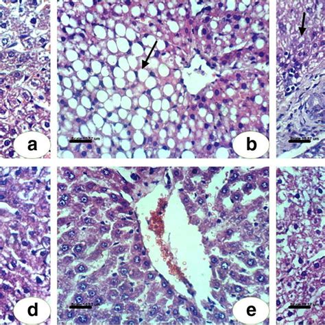 Umbelliferone Attenuates Ccl4 Induced Liver Fibrosis In Rats A
