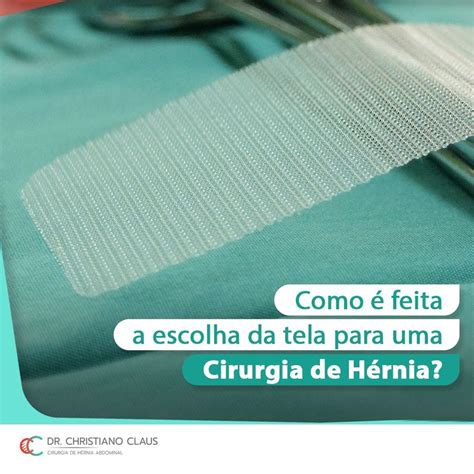 Como é Feita A Escolha Da Tela Para Uma Cirurgia De Hérnia Dr