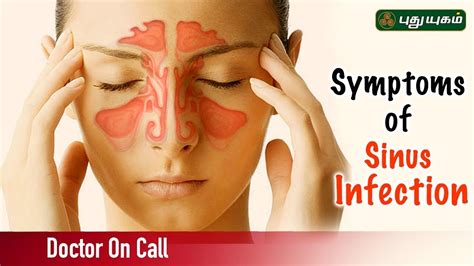 symptoms and causes of sinus infection sinusitis doctor on call 03 07 2019 youtube