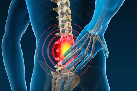 6 Common Causes Back Pain Singapore Sports Clinic