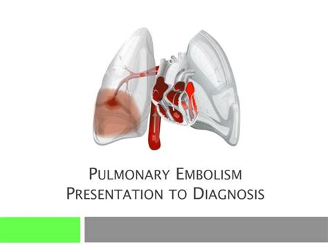 Ppt Pulmonary Embolism Presentation To Diagnosis Powerpoint