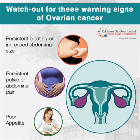 Ovarian Cancer Symptoms Ovarian Cancer Awareness Month Healthwatch