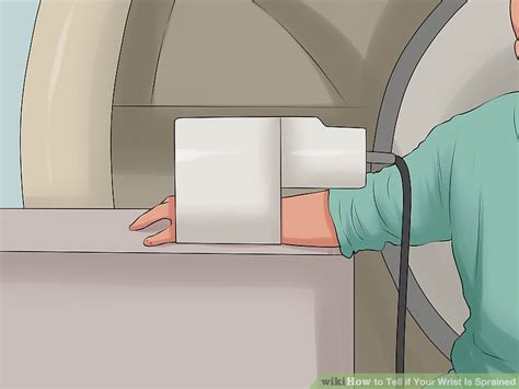 See full list on mayoclinic.org How to Tell if Your Wrist Is Sprained: 7 Steps (with Pictures)