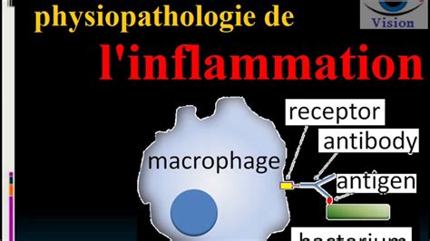 Inflammation Aiguë Et Chronique Physiologie Et Physiopathologie Youtube