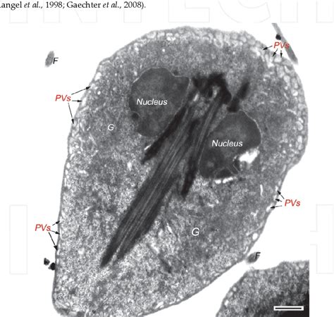 Figure From The Unique Endosomal Lysosomal System Of Giardia Lamblia Semantic Scholar