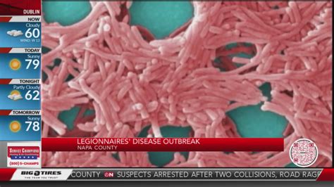 Legionnaires Disease Outbreak Confirmed In Napa County Kron4