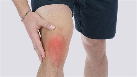 Symptoms And Causes Of Knee Pain Page 8 Entirely Health