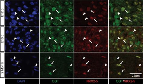 Nuclear Localization Of Ogt In Cardiomyocytes At Different Stages