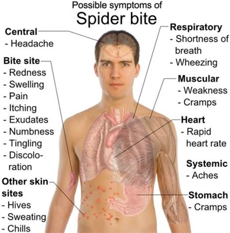 A protein venom is produced by the black widow spider and this venom affects the nervous system of the victim. The Poisonous Black Widow Spider | Spider bites, Spider ...