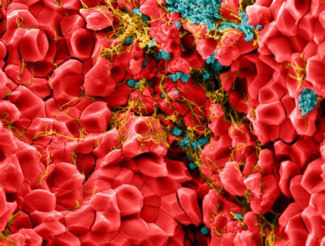 Red blood cells (erythrocytes), white blood cells (leukocytes) and platelets. Red blood cells take on many-sided shape during clotting