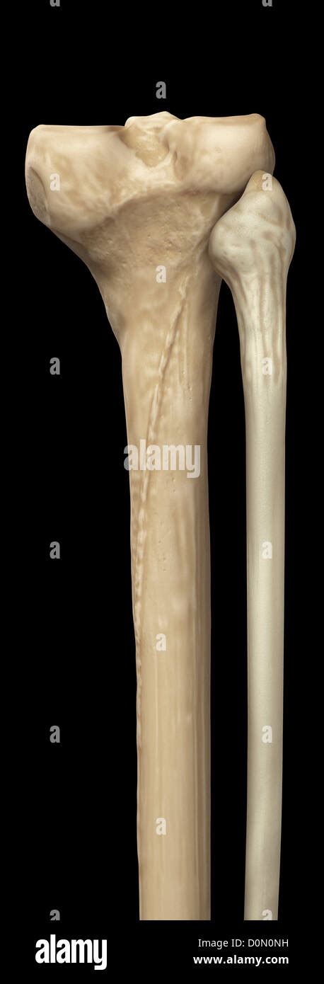 Model Of The Tibia And Fibula Bones That Form Part Of The Human Leg