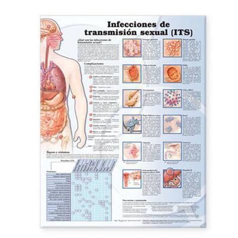 Sexually Transmitted Infections Anatomical Chart In Spanish