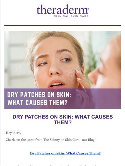 Theraderm What Causes Dry Patches On Skin Find Out Here Milled