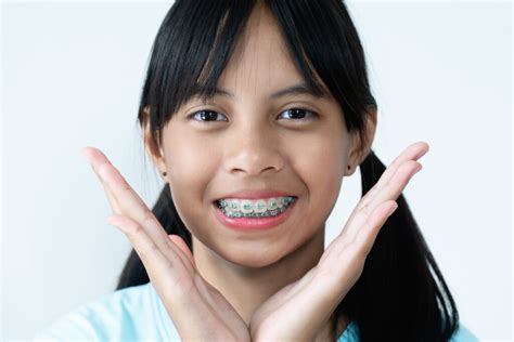 Why To Avoid Fake Braces And Look For Safer Alternatives Thurman Orthodontics