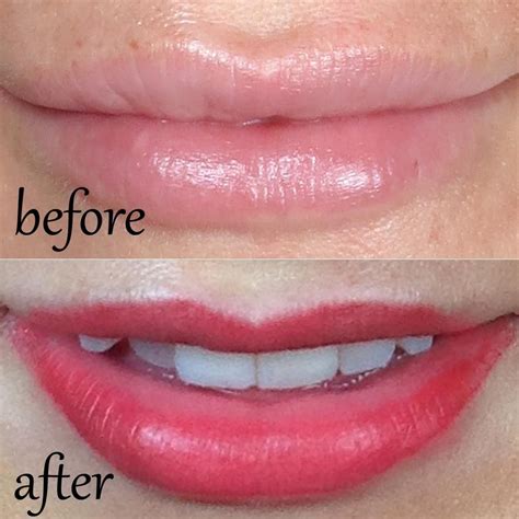 Permanent Makeup Before And After Beautiful Lips Are A Work Of Art